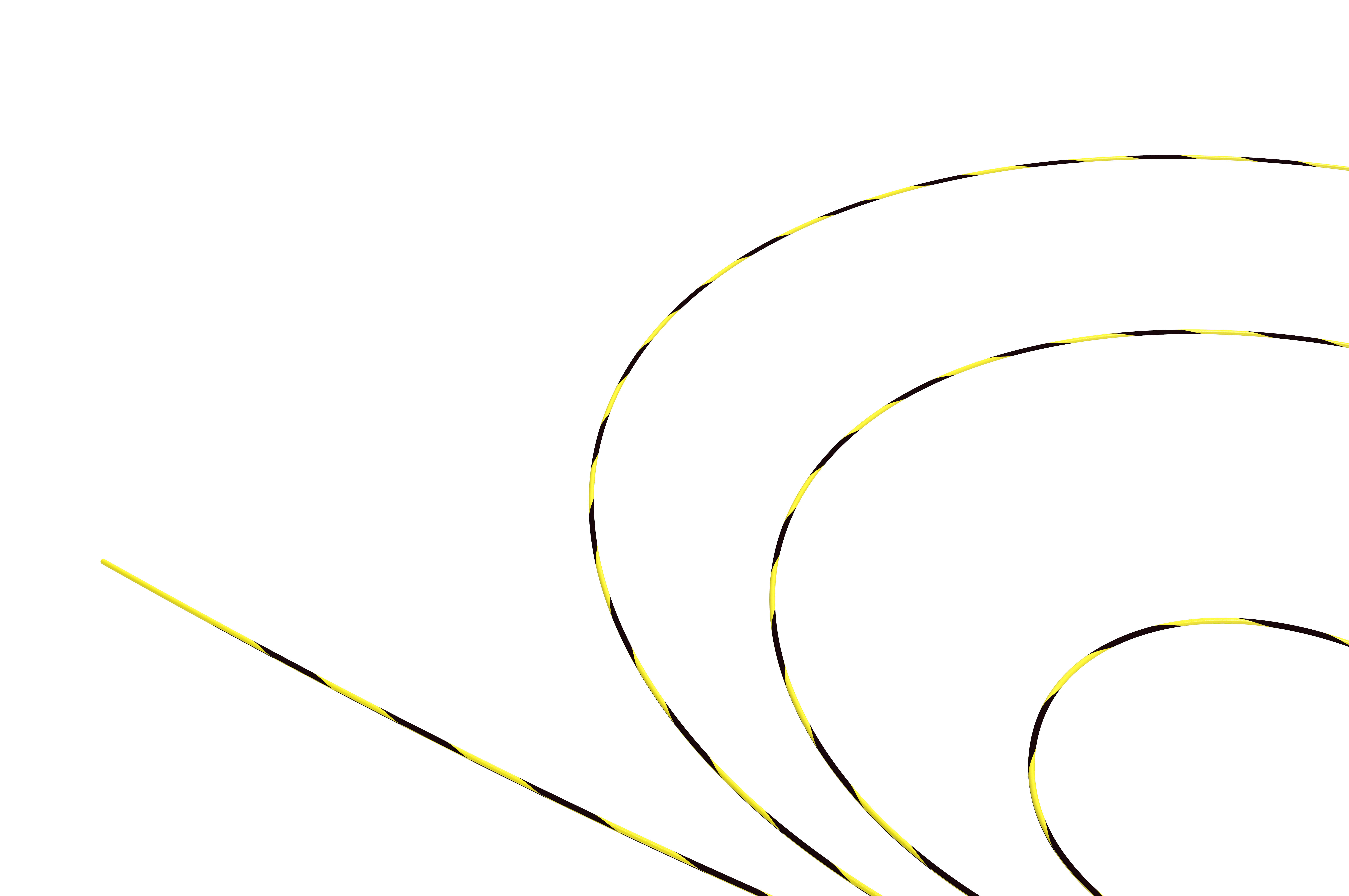 Urological Zebra Guidewire