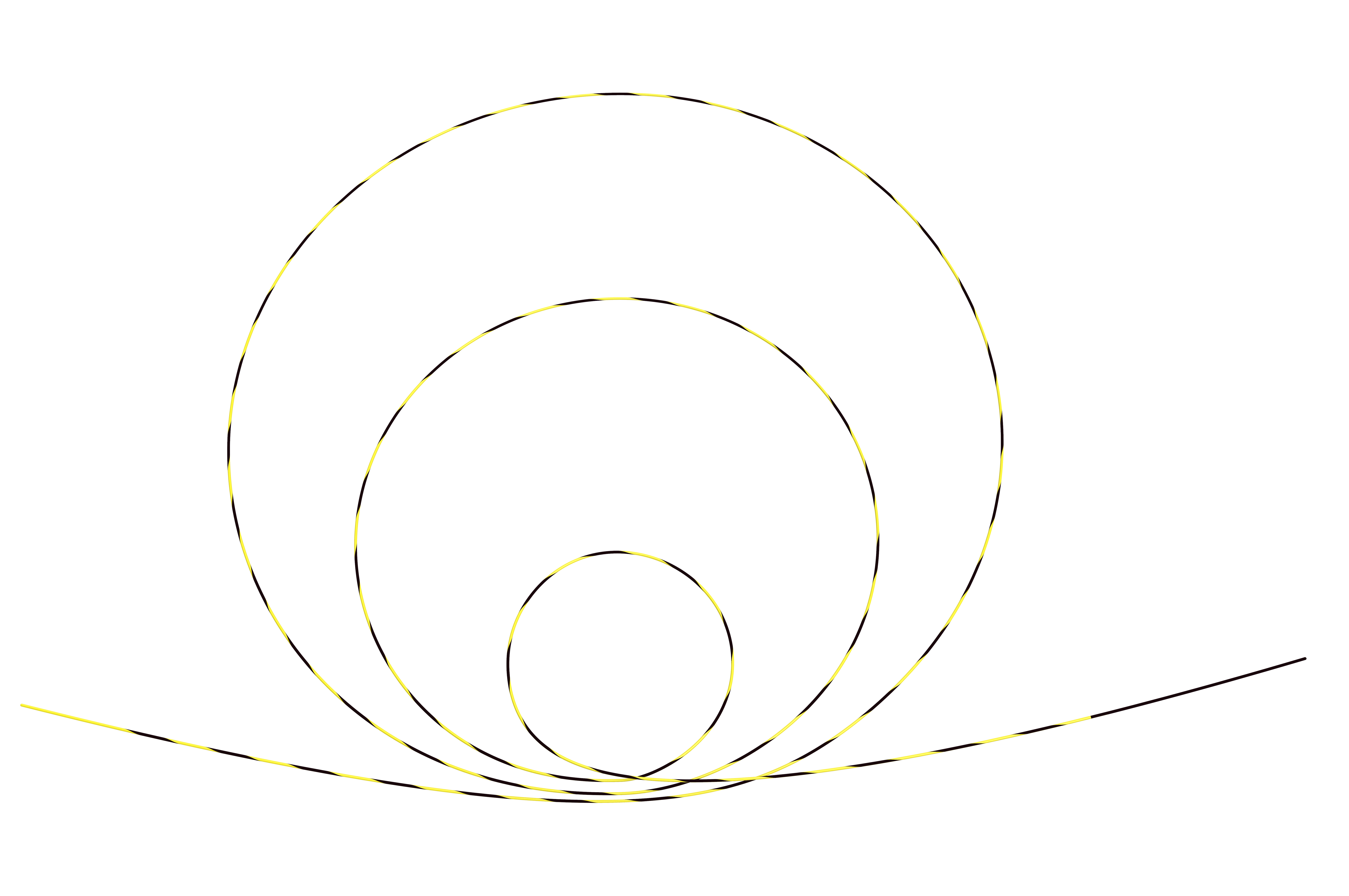Urological Zebra Guidewire